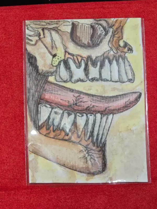 Exposed Decay aceo art card