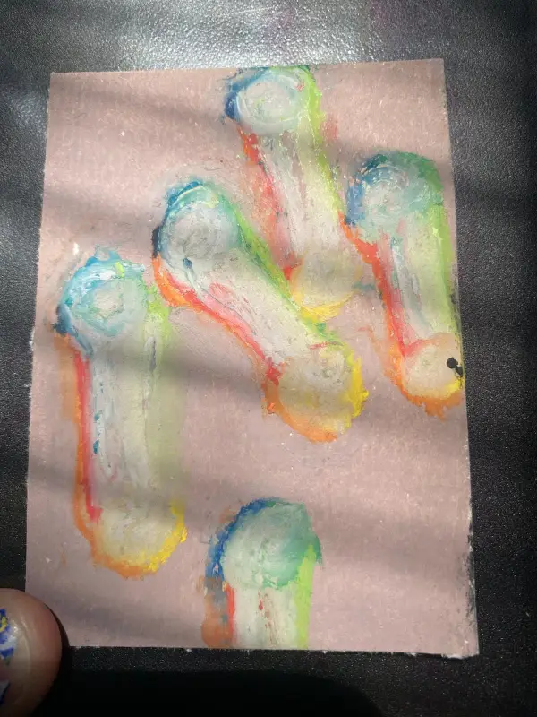 Corynebacterium diphtheriae aceo art card