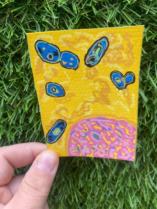 Yersinia pestis aceo art card